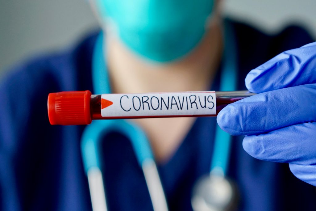 koronavírus, járványkezelés