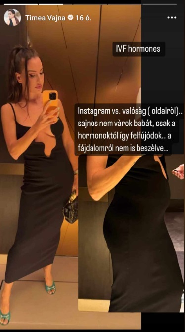 Tímea kendőzetlen őszinteséggel beszél a nehézségekről / Kép forrása: Instagram / Vajna Tímea