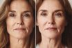 Retinol