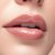 Mosoly botox helyett