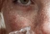 U7929842649 French 20s Woman Holding Ice Cube Against Face Fres 1c004098 A0d5 427f 9ee9 De7f9854ea0e 1