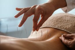 Acupuncture Back Treatment