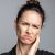 Masseter Botox