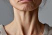 Masseter Botox