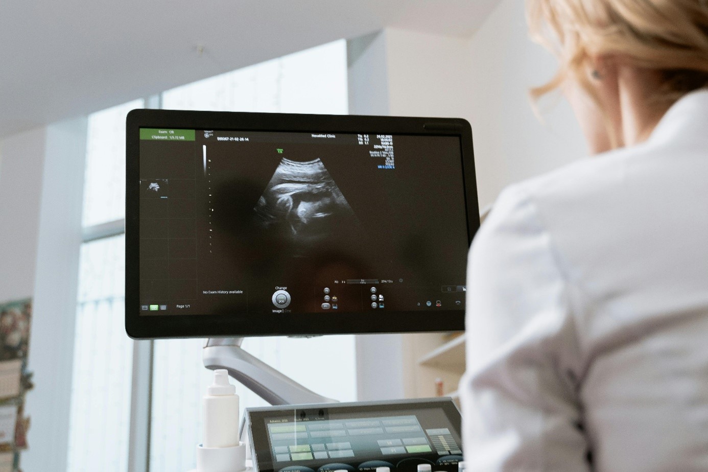 Menopauza vagy betegség? – Így különböztetheted meg a tüneteket 1 Cikk6kep2