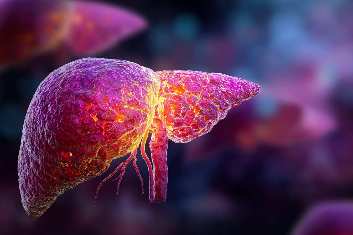 hepatitis